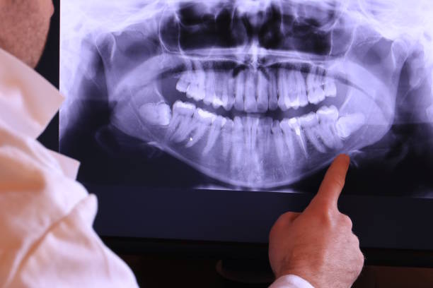 Best Emergency Dental Surgery in Channelview, TX